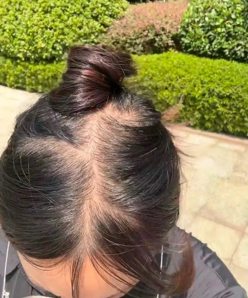Prima del trattamento